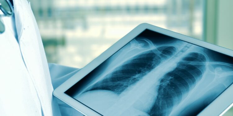 Telerradiologia: tecnologia garante diagnóstico de qualidade para todo Brasil