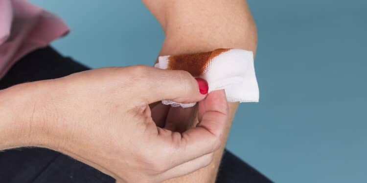 Hemofilia: tire suas dúvidas sobre essa doença crônica e rara