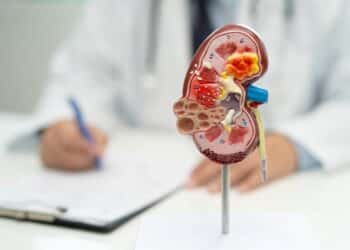 Estudo da Hapvida NotreDame Intermédica indica que cerca de 4% dos beneficiários adultos têm algum grau de doença renal crônica