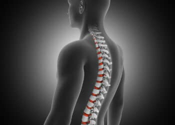 Escoliose em adolescentes: como ajudar seu filho antes e depois do diagnóstico