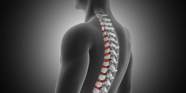 Escoliose em adolescentes: como ajudar seu filho antes e depois do diagnóstico