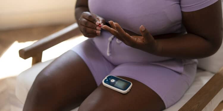 A cirurgia metabólica como aliada no controle do diabetes tipo 2