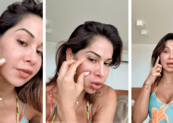 O riscos por trás das substâncias permanentes em procedimentos estéticos