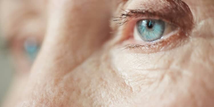 Novas terapias e avanços para a catarata aliam inovação e abordagens promissoras