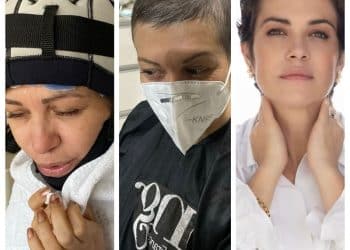 Médica conta que a perda do cabelo durante o tratamento de câncer de mama mudou sua percepção da própria beleza