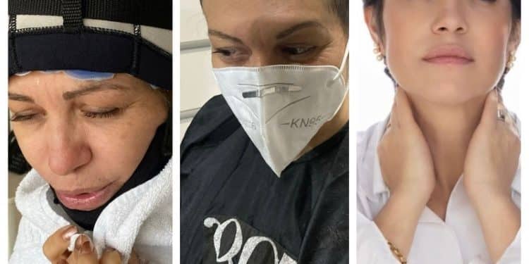 Médica conta que a perda do cabelo durante o tratamento de câncer de mama mudou sua percepção da própria beleza