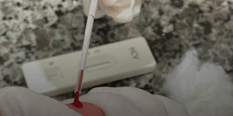 Casos de HIV e sífilis caem em Araxá em 2025; hepatite C registra aumento