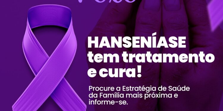 Campanha Janeiro Roxo reforça importância do diagnóstico precoce da hanseníase
