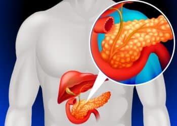 Morte de atriz brasileira Titina Medeiros acende o alerta para o câncer de pâncreas, um dos tumores mais agressivos e silenciosos