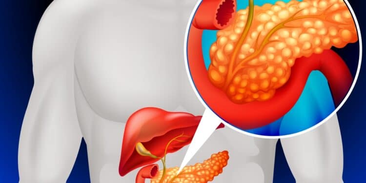 Morte de atriz brasileira Titina Medeiros acende o alerta para o câncer de pâncreas, um dos tumores mais agressivos e silenciosos