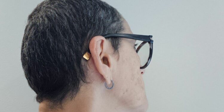 A CARECA QUE LIBERTA